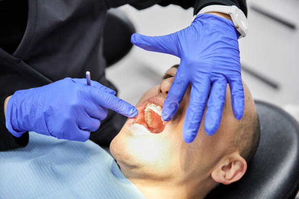 Best Root Canal Emergency Dentist  in Olive Branch, MS